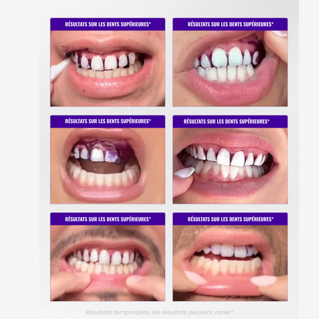 Bandes de blanchiment dentaire - Zelya™ Zelya