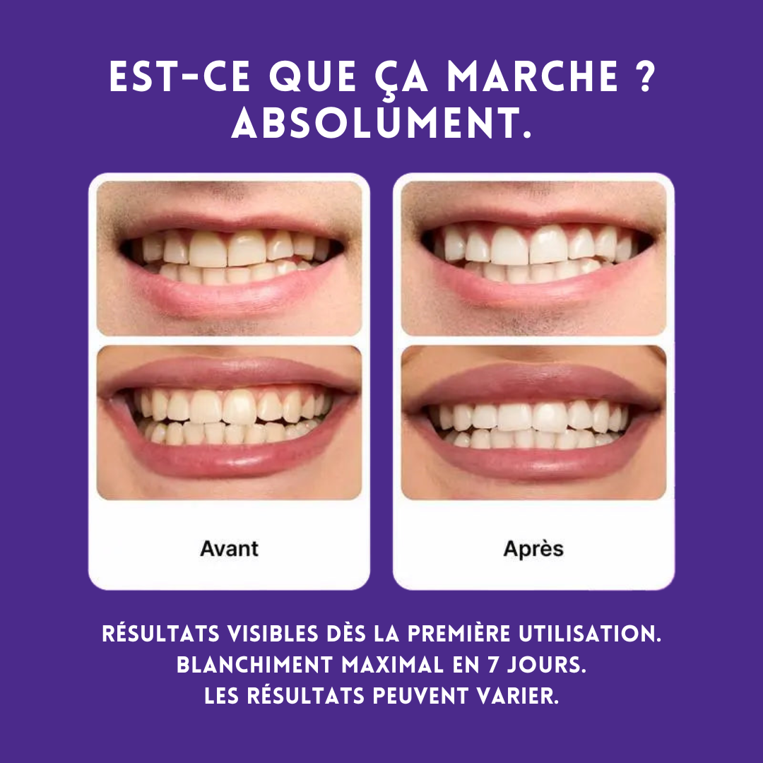 Bandes de blanchiment dentaire - Zelya™