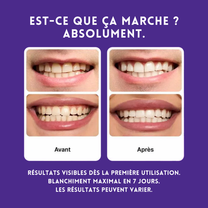 Bandes de blanchiment dentaire - Zelya™