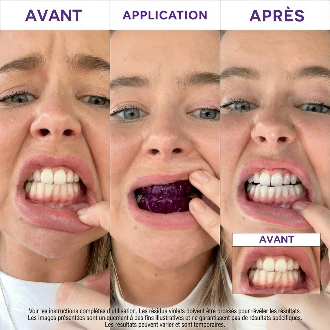 Bandes de blanchiment dentaire - Zelya™ Zelya